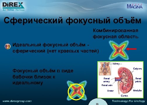 Сферический фокусный объём Комбинированная фокусная область Идеальный фокусный объём - сферический (нет краевых частей)