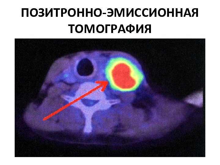 ПОЗИТРОННО-ЭМИССИОННАЯ ТОМОГРАФИЯ 