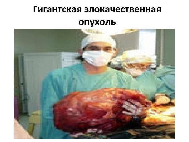 Гигантская злокачественная опухоль 