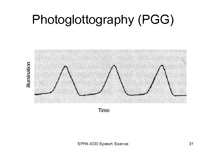 illumination Photoglottography (PGG) Time SPPA 4030 Speech Science 31 