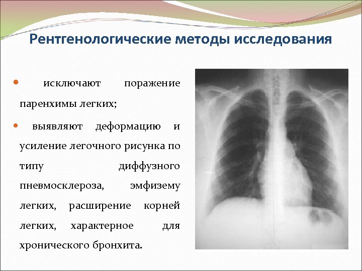 Рентгенологические методы исследования исключают поражение паренхимы легких; выявляют деформацию и усиление легочного рисунка по