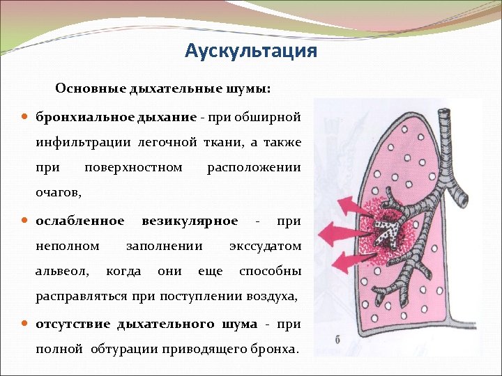 Аускультация Основные дыхательные шумы: бронхиальное дыхание - при обширной инфильтрации легочной ткани, а также