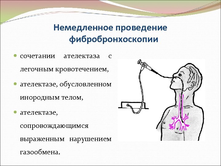 Немедленное проведение фибробронхоскопии сочетании ателектаза с легочным кровотечением, ателектазе, обусловленном инородным телом, ателектазе, сопровождающимся