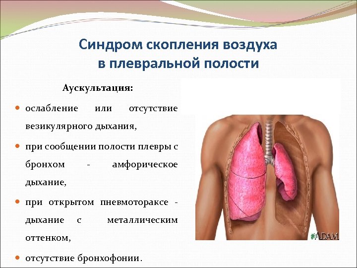 Синдром скопления воздуха в плевральной полости Аускультация: ослабление или отсутствие везикулярного дыхания, при сообщении