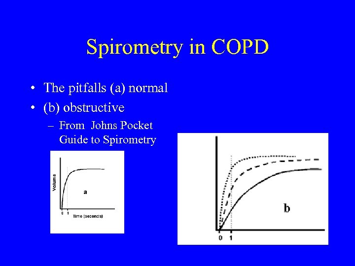 Spirometry in COPD • The pitfalls (a) normal • (b) obstructive – From Johns