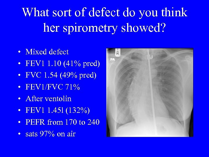 What sort of defect do you think her spirometry showed? • • Mixed defect