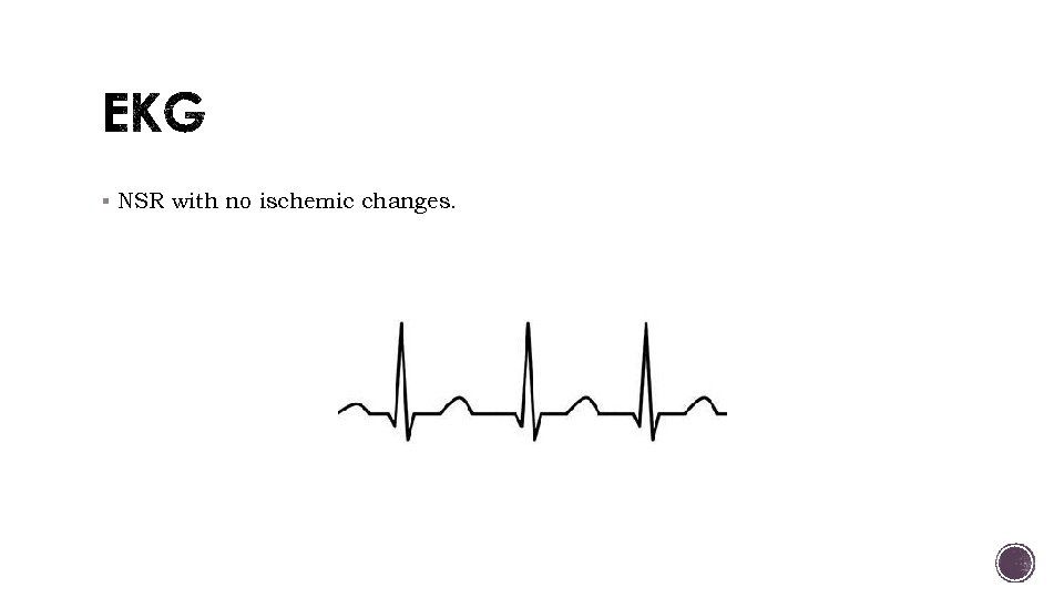 § NSR with no ischemic changes. 