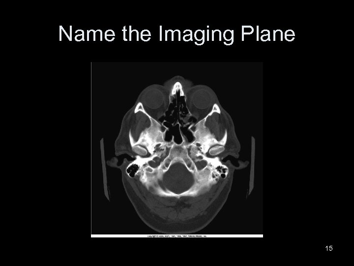 Name the Imaging Plane 15 