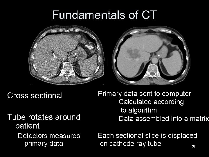 Fundamentals of CT Cross sectional Tube rotates around patient Detectors measures primary data Primary