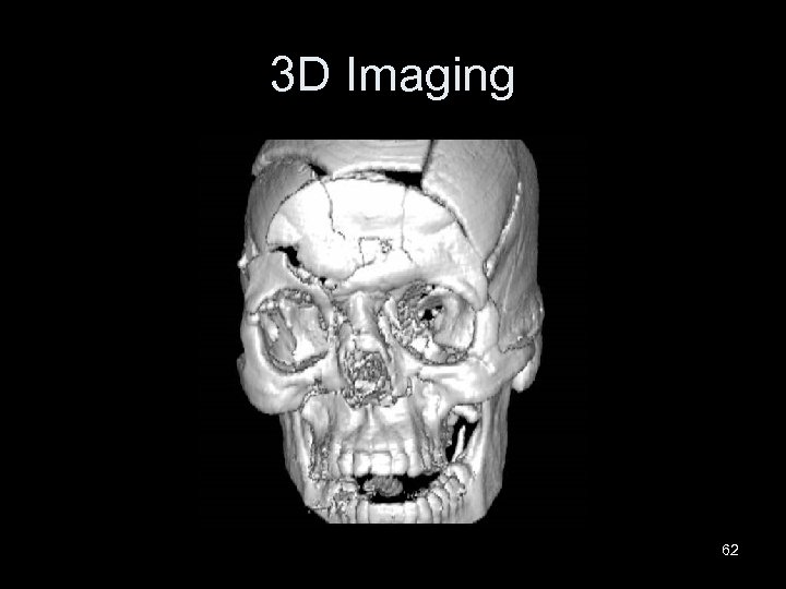 3 D Imaging 62 