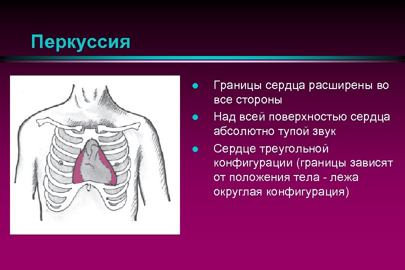 Перкуссия сердца презентация