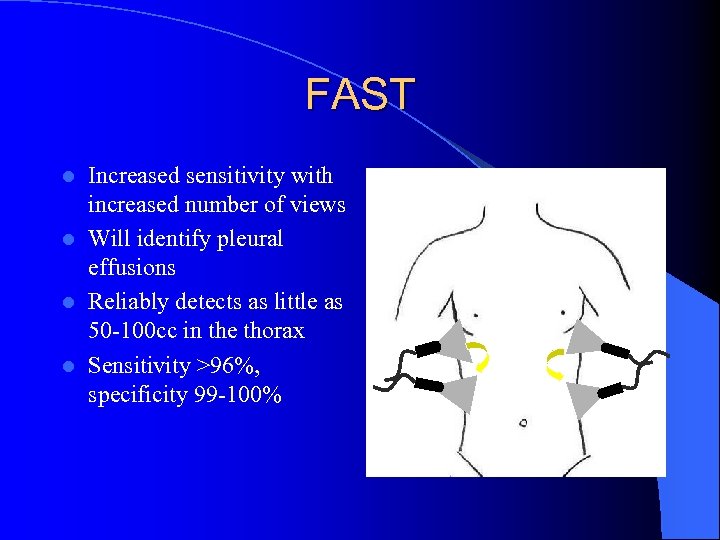 FAST Increased sensitivity with increased number of views l Will identify pleural effusions l