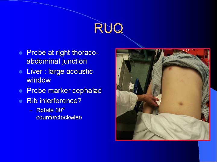 RUQ Probe at right thoracoabdominal junction l Liver : large acoustic window l Probe