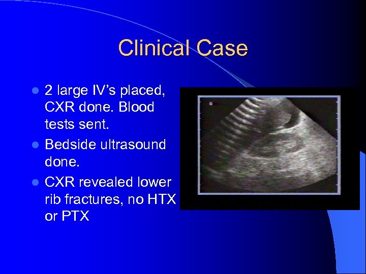 Clinical Case 2 large IV’s placed, CXR done. Blood tests sent. l Bedside ultrasound