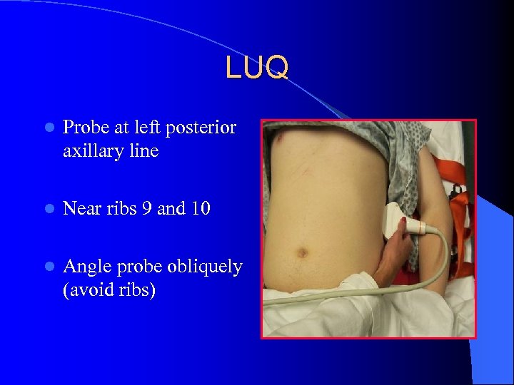 LUQ l Probe at left posterior axillary line l Near ribs 9 and 10