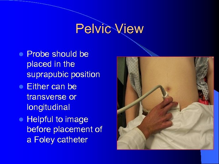 Pelvic View Probe should be placed in the suprapubic position l Either can be