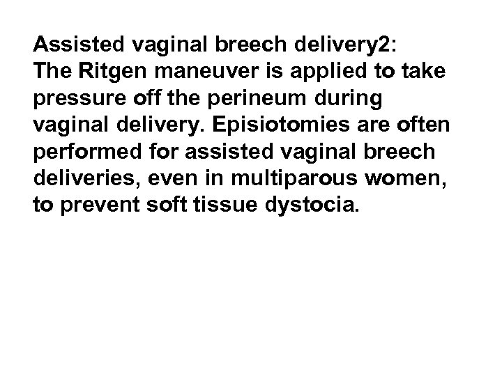 Assisted vaginal breech delivery 2: The Ritgen maneuver is applied to take pressure off