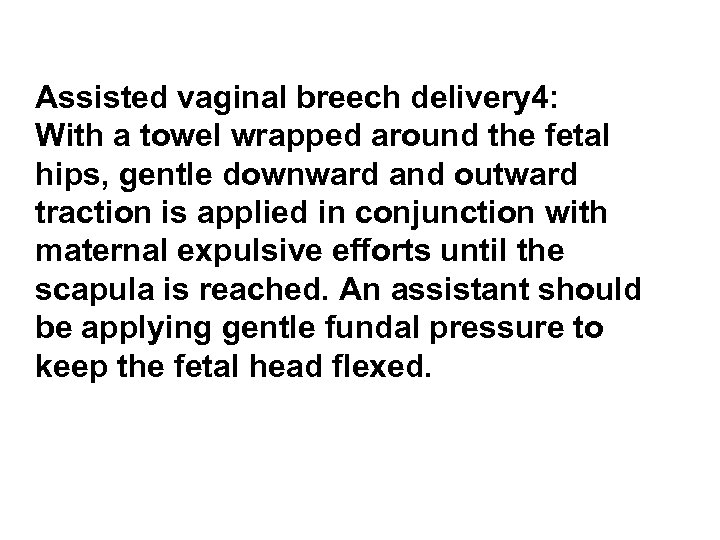 Assisted vaginal breech delivery 4: With a towel wrapped around the fetal hips, gentle