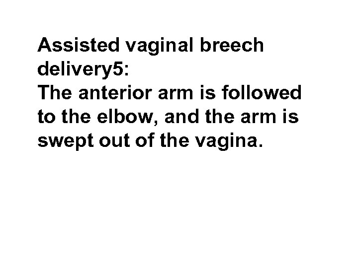 Assisted vaginal breech delivery 5: The anterior arm is followed to the elbow, and