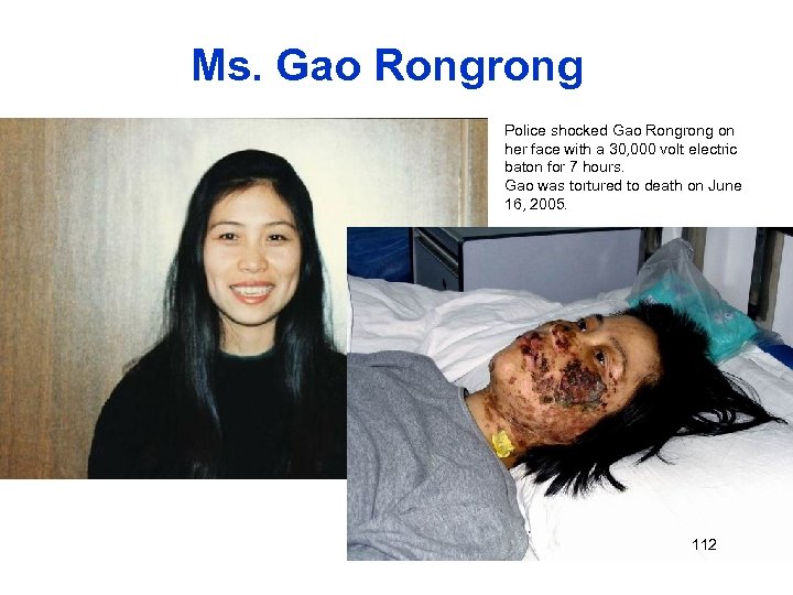 Ms. Gao Rongrong Police shocked Gao Rongrong on her face with a 30, 000