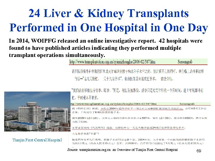 24 Liver & Kidney Transplants Performed in One Hospital in One Day In 2014,