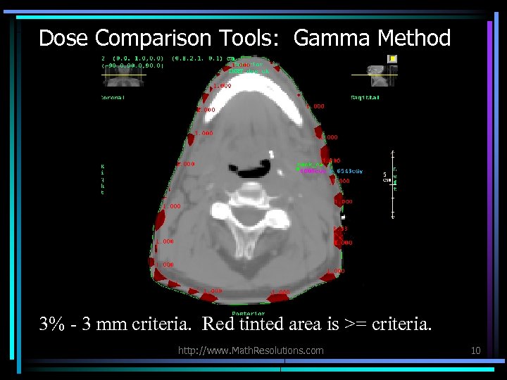 Dose Comparison Tools: Gamma Method 3% - 3 mm criteria. Red tinted area is