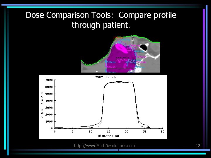 Dose Comparison Tools: Compare profile through patient. http: //www. Math. Resolutions. com 12 