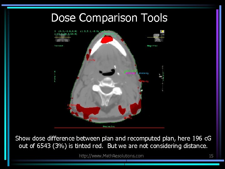 Dose Comparison Tools Show dose difference between plan and recomputed plan, here 196 c.