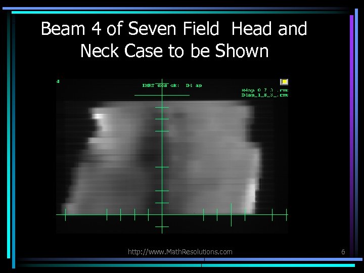 Beam 4 of Seven Field Head and Neck Case to be Shown http: //www.