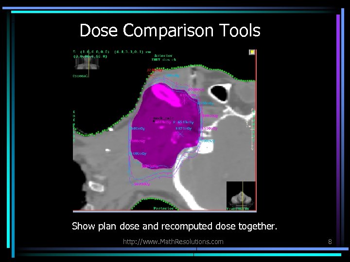 Dose Comparison Tools Show plan dose and recomputed dose together. http: //www. Math. Resolutions.