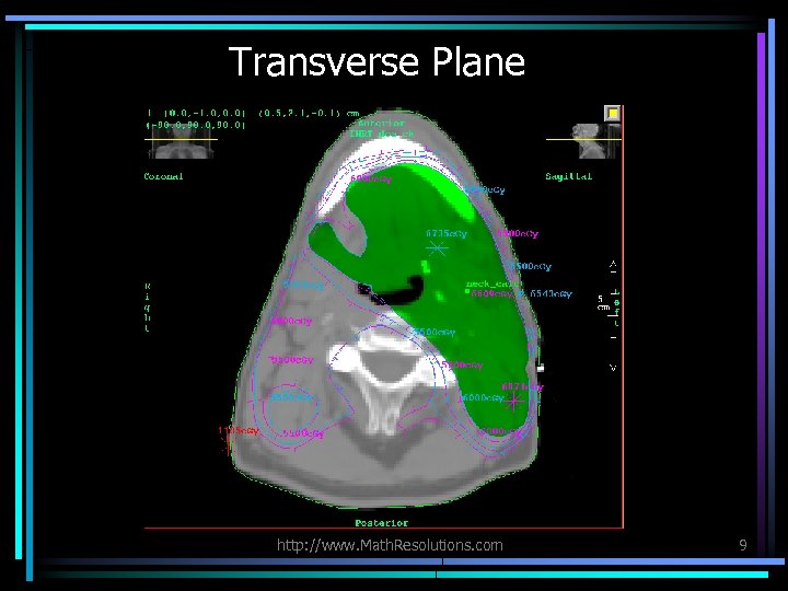 Transverse Plane http: //www. Math. Resolutions. com 9 