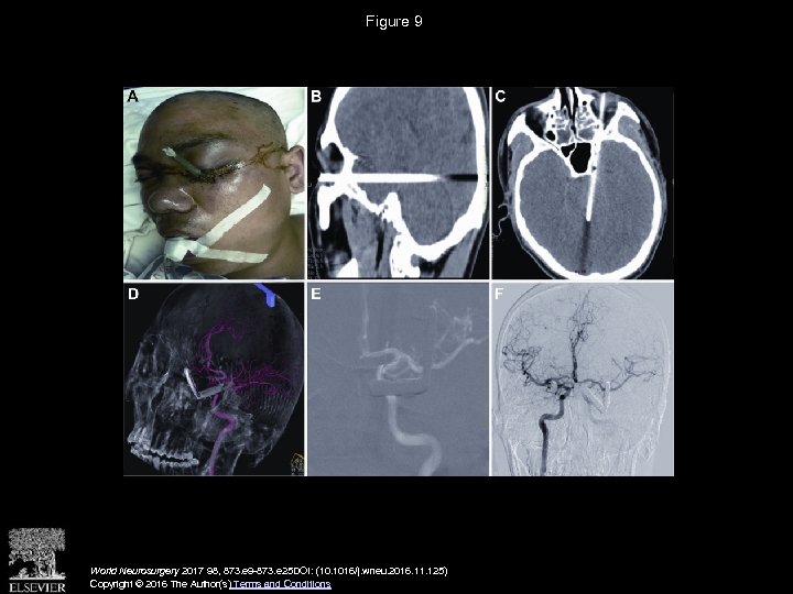 Figure 9 World Neurosurgery 2017 98, 873. e 9 -873. e 25 DOI: (10.