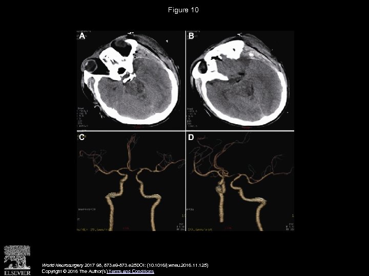 Figure 10 World Neurosurgery 2017 98, 873. e 9 -873. e 25 DOI: (10.