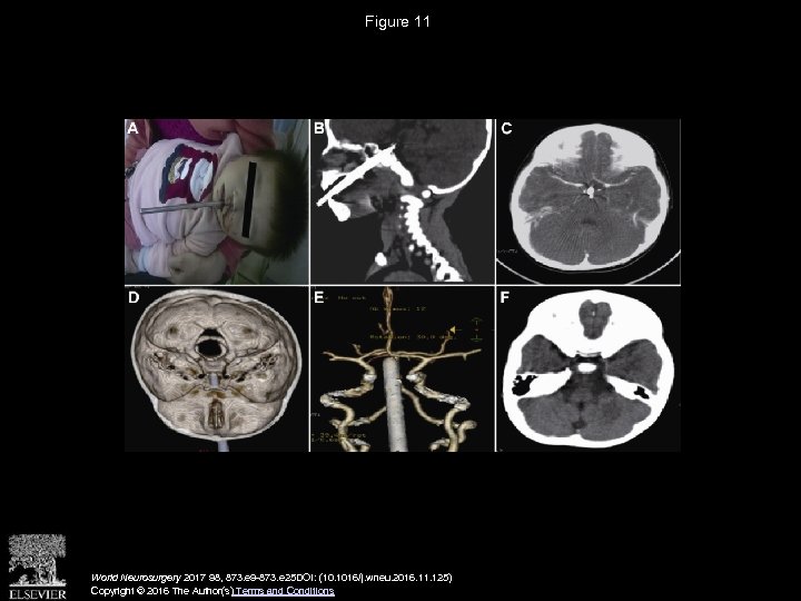 Figure 11 World Neurosurgery 2017 98, 873. e 9 -873. e 25 DOI: (10.