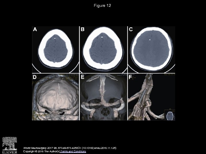 Figure 12 World Neurosurgery 2017 98, 873. e 9 -873. e 25 DOI: (10.