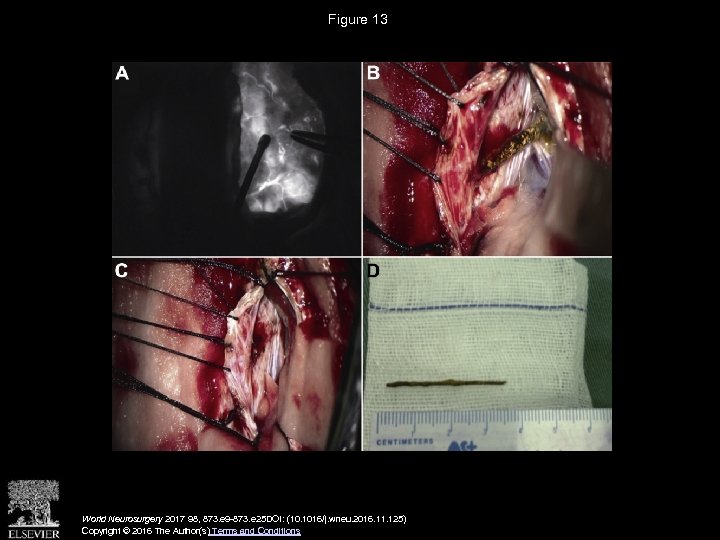 Figure 13 World Neurosurgery 2017 98, 873. e 9 -873. e 25 DOI: (10.