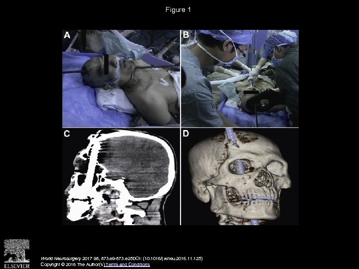 Figure 1 World Neurosurgery 2017 98, 873. e 9 -873. e 25 DOI: (10.