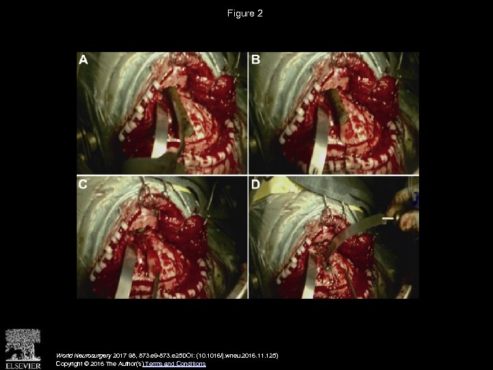 Figure 2 World Neurosurgery 2017 98, 873. e 9 -873. e 25 DOI: (10.
