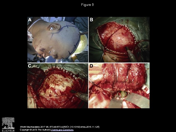 Figure 5 World Neurosurgery 2017 98, 873. e 9 -873. e 25 DOI: (10.