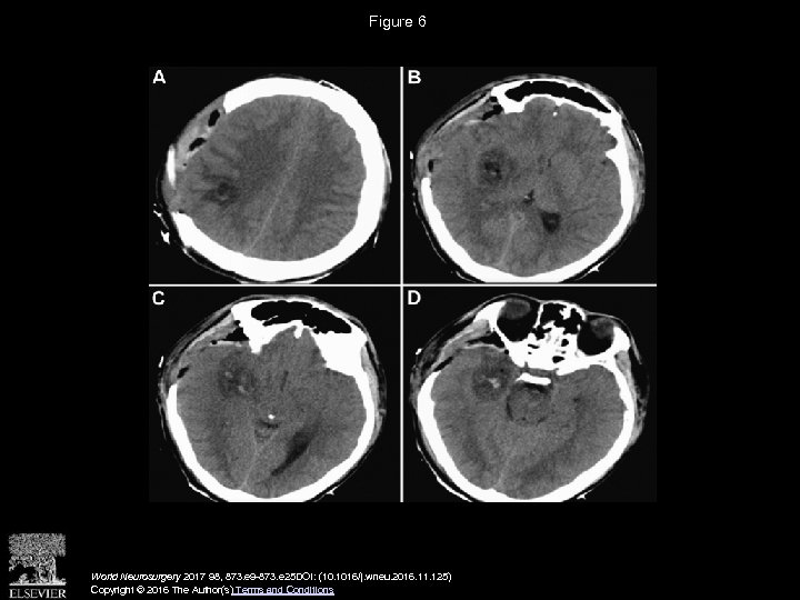 Figure 6 World Neurosurgery 2017 98, 873. e 9 -873. e 25 DOI: (10.
