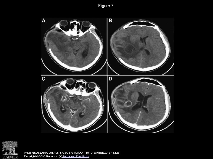 Figure 7 World Neurosurgery 2017 98, 873. e 9 -873. e 25 DOI: (10.