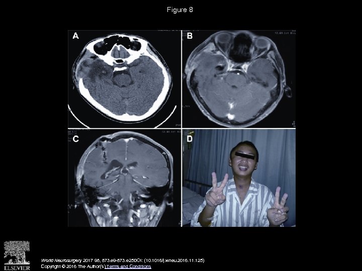 Figure 8 World Neurosurgery 2017 98, 873. e 9 -873. e 25 DOI: (10.