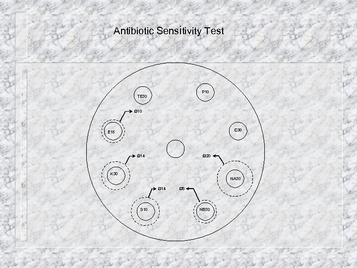 Antibiotic Sensitivity Test P 10 TE 30 Ø 10 C 30 E 15 Ø