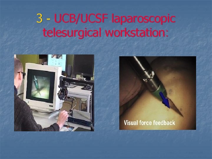 3 - UCB/UCSF laparoscopic telesurgical workstation: 