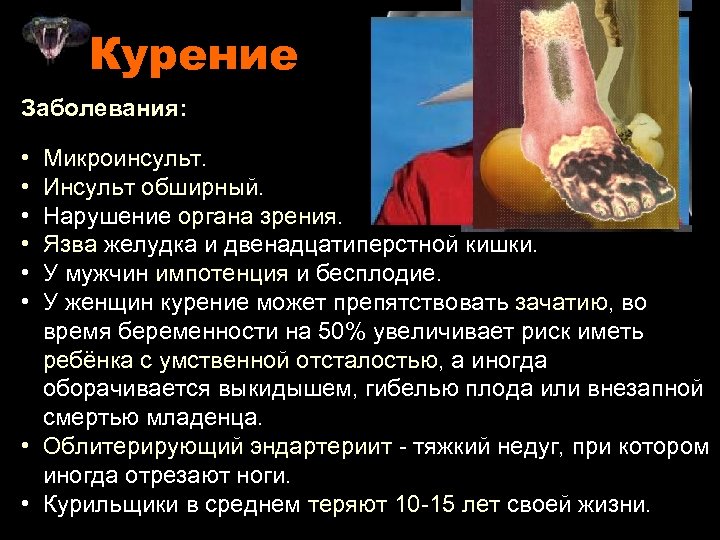 Болезни от курения презентация