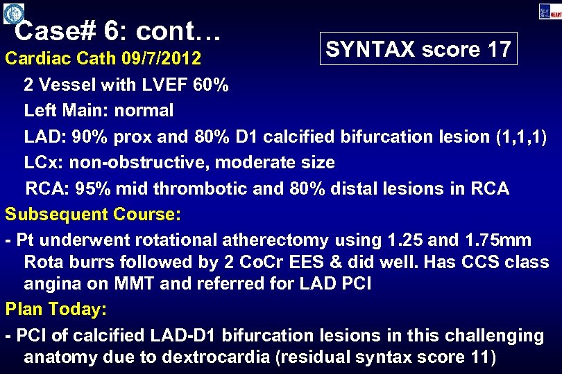 Case# 6: cont… SYNTAX score 17 Cardiac Cath 09/7/2012 2 Vessel with LVEF 60%