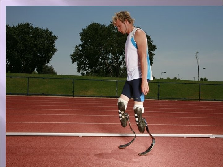 Инвалид без ноги фото