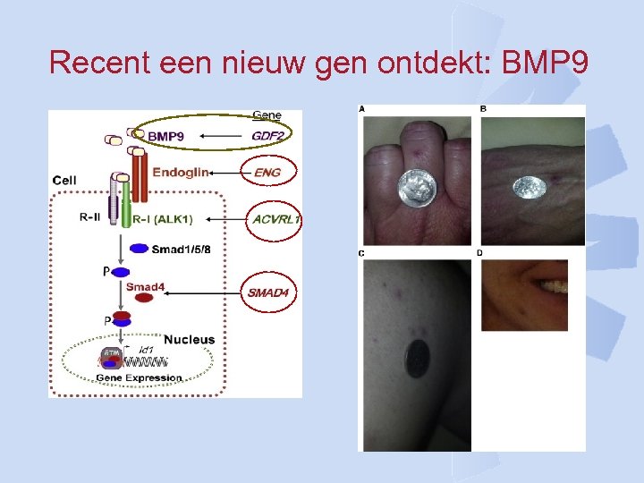 Recent een nieuw gen ontdekt: BMP 9 