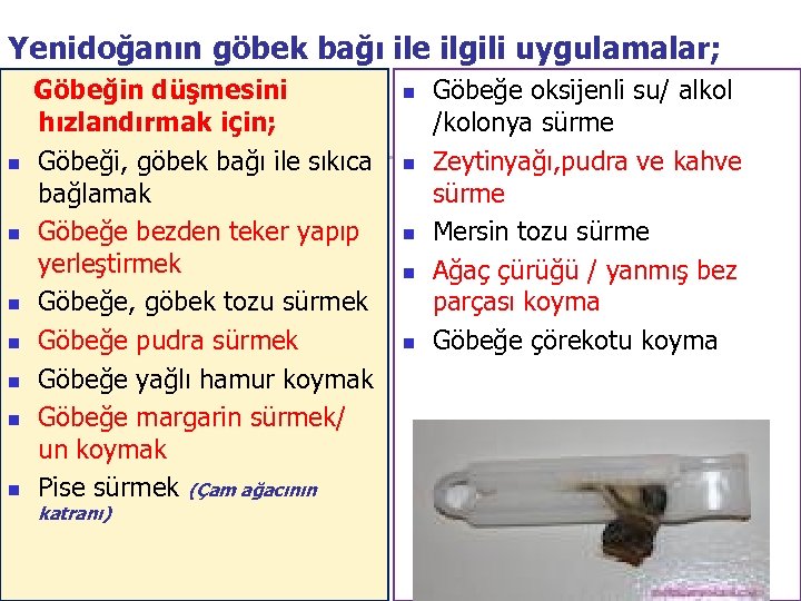 Yenidoğanın göbek bağı ile ilgili uygulamalar; n n n n Göbeğin düşmesini hızlandırmak için;