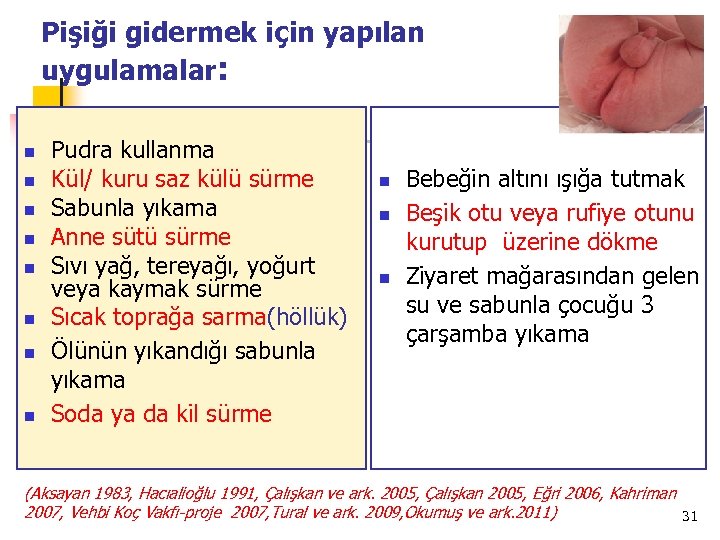 Pişiği gidermek için yapılan uygulamalar: n n n n Pudra kullanma Kül/ kuru saz